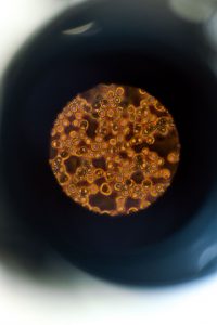 blood cells seen in microscope