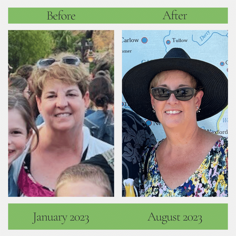 Close up of Karen before and after following Dr. Rob Lindsey's functional medicine care plan.
